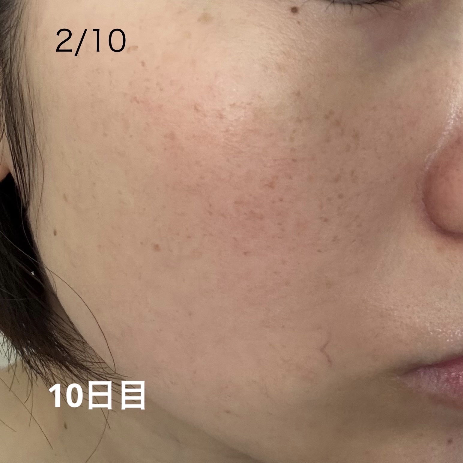 メラノフォーカスＥＶ 本体（45g）/HAKU/美容液を使ったクチコミ（3枚目）