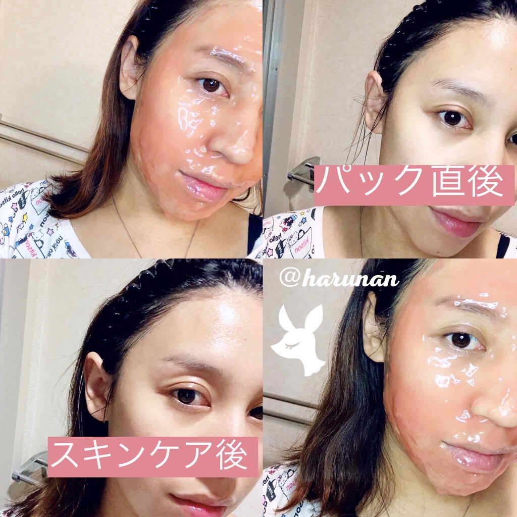 HARUNAN on LIPS 「炭酸ガスパックデビューしてみない?💗/2枚目注意⚠️⚠️⚠️▫..」(2枚目)