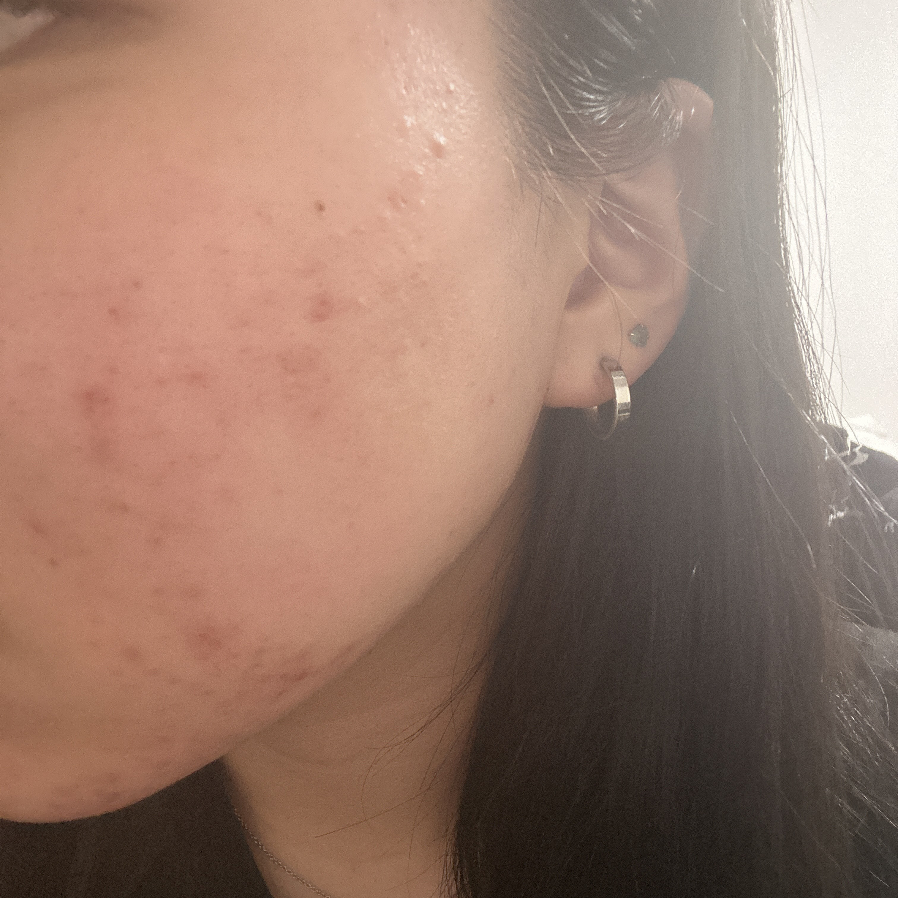 メイク落としジェル/オードムーゲ/クレンジングジェルを使ったクチコミ（2枚目）