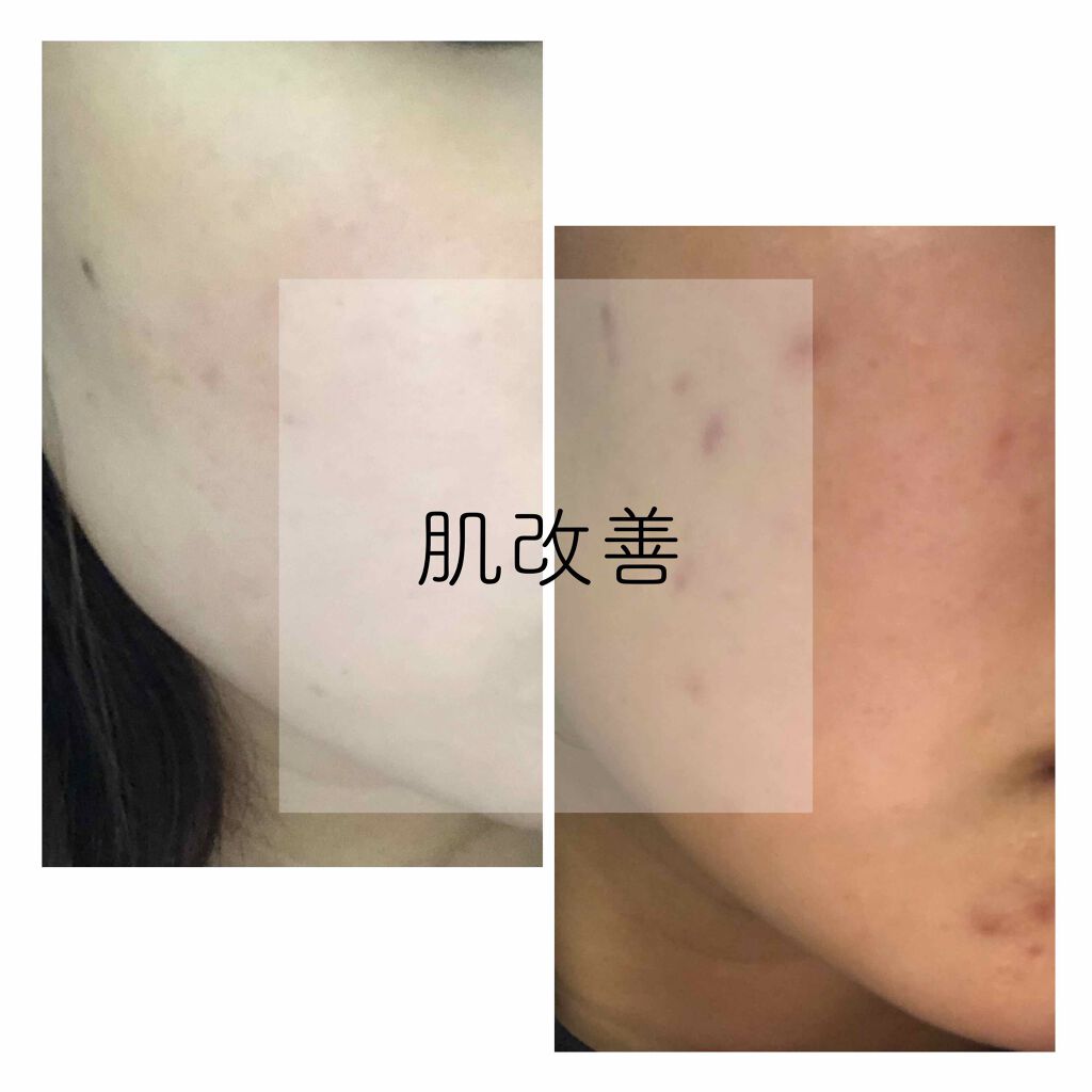 ロゼットゴマージュ/ロゼット/ピーリングを使ったクチコミ（1枚目）