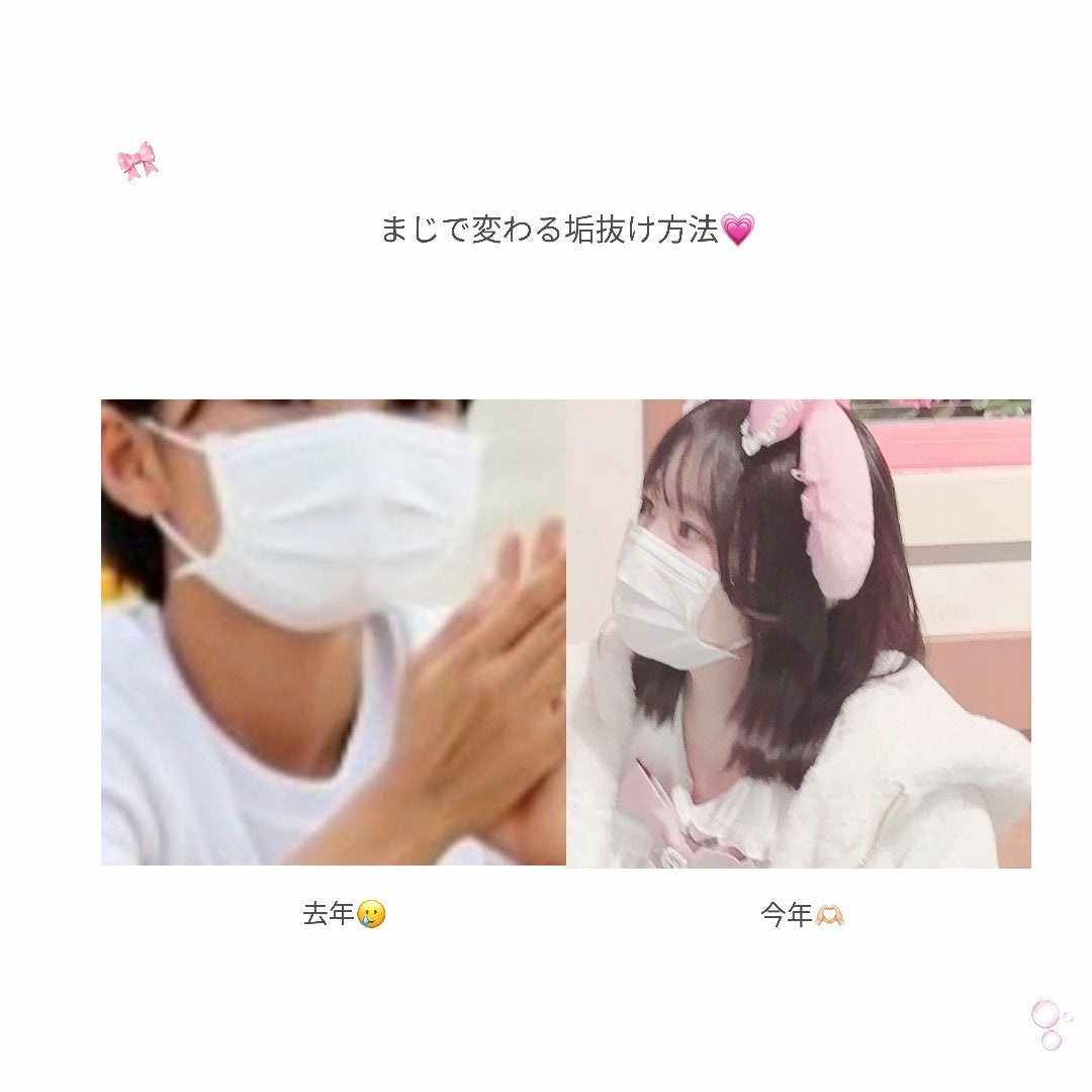 DHC ビタミンCハードカプセル/DHC/美容サプリメントを使ったクチコミ(1枚目)