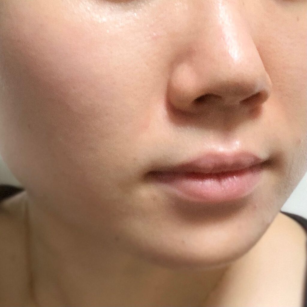 シカフルカーミングマスク/beplain/シートマスク・パックを使ったクチコミ（3枚目）