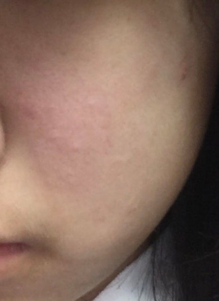 ããªðŠð on LIPS ãããããã®åç²§æ°Žãè¬æããŠãã ããïŒä»ã«ãæ²»ãæ¹æ³ã¯ããªãã§ã..ãïŒ4æç®ïŒ