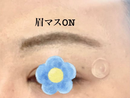 プロCICA クリアスポットパッチ/VT/その他スキンケアを使ったクチコミ(3枚目)