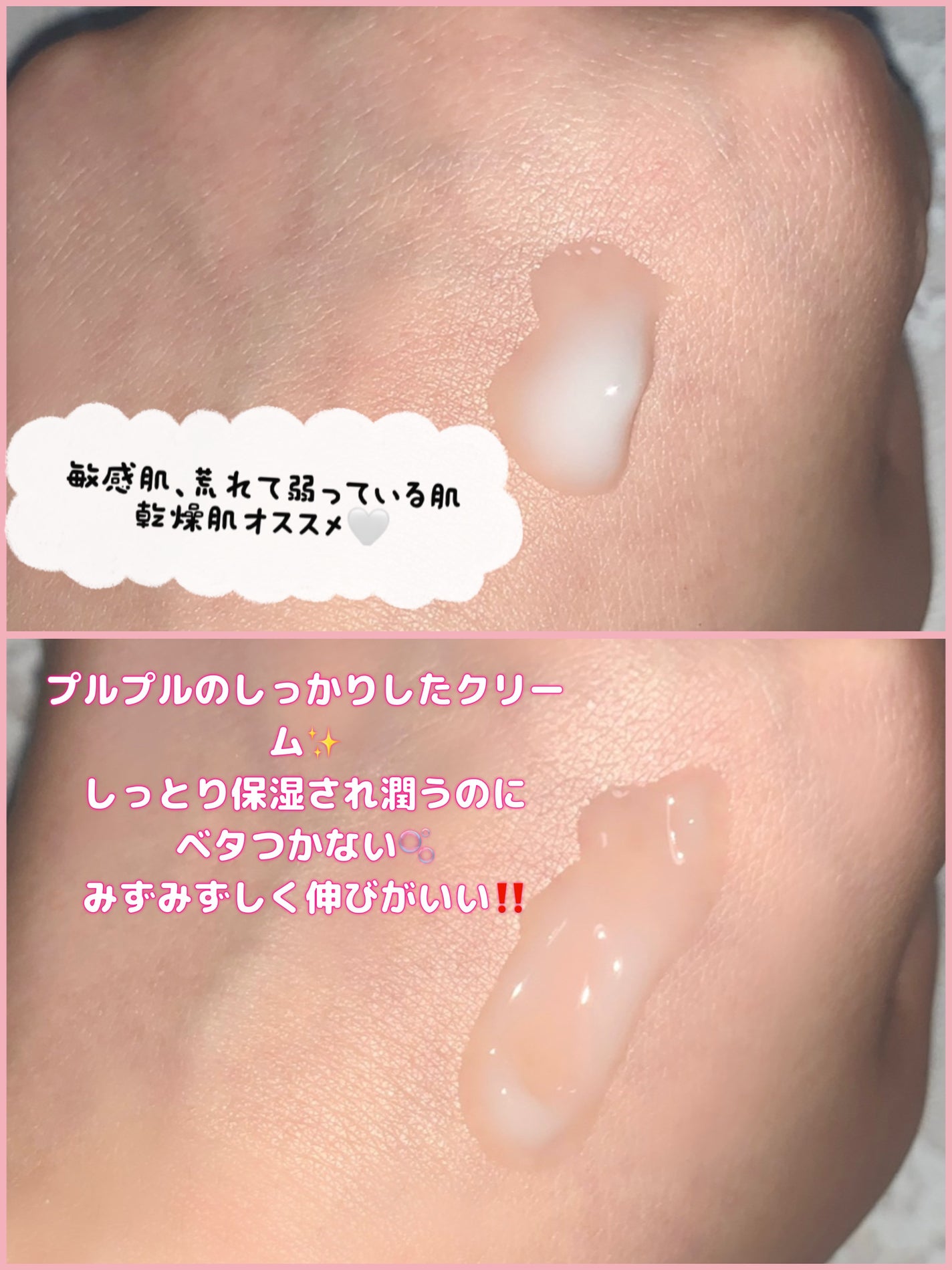 レッドブレミッシュ クリアスージングクリーム/Dr.G/フェイスクリームを使ったクチコミ(5枚目)