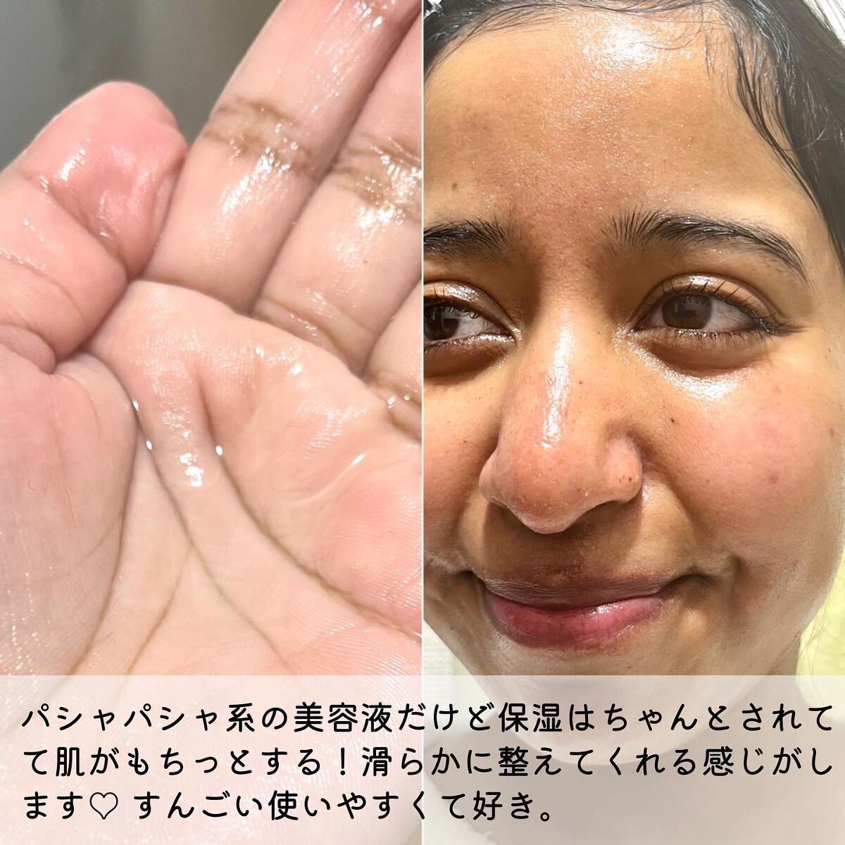 AZ アゼフィットスポッツ/NIKI PITA/フェイスクリームを使ったクチコミ(5枚目)