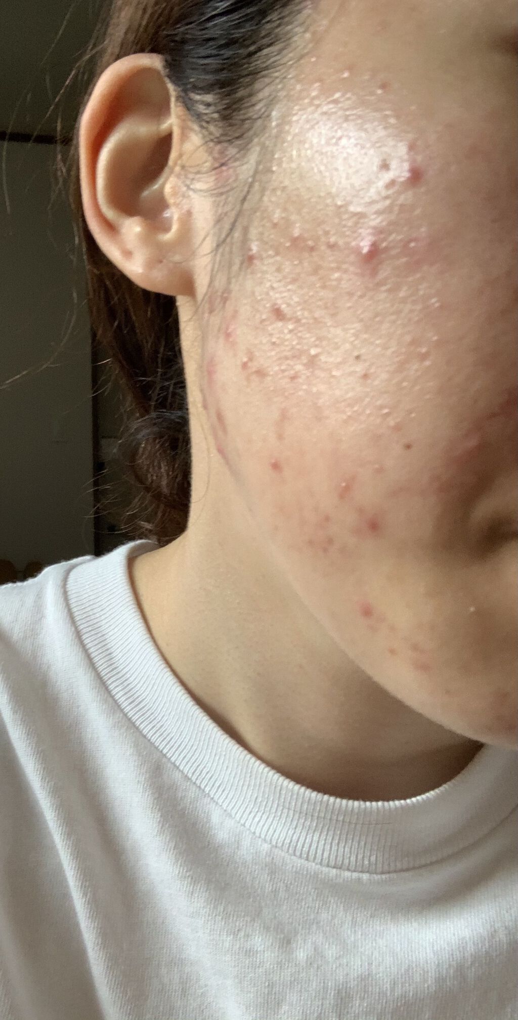 潤浸保湿 乳液/キュレル/乳液を使ったクチコミ（3枚目）