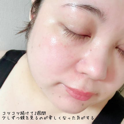 インテンシブ PRO+ セロム/エステダム/美容液を使ったクチコミ(5枚目)