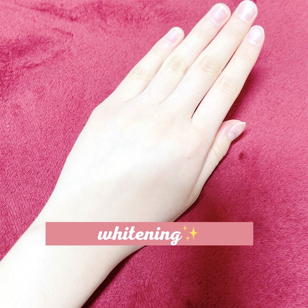 薬用ホワイトニング ハンドクリーム モイストジェル/コエンリッチQ10/ハンドクリームを使ったクチコミ（2枚目）