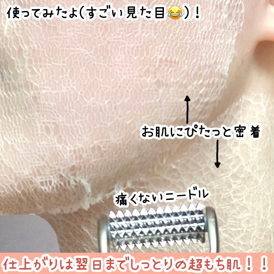 リンクルフィットマスク+ニードルローラー/MEDITHERAPY/美顔器・マッサージを使ったクチコミ(5枚目)