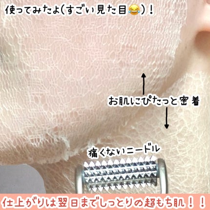 リンクルフィットマスク+ニードルローラー/MEDITHERAPY/美顔器・マッサージを使ったクチコミ(5枚目)
