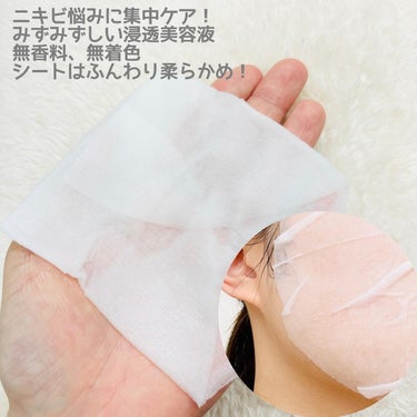 🤲🏻肌美精🤲🏻

CHOI薬用マスク ニキビケア ［医薬部外品］
10枚入り　¥824

˚˙༓࿇༓˙˚˙༓࿇༓˙˚˙༓࿇༓˙˚˚˙༓࿇༓˙˚˙༓࿇༓˙˚˙༓࿇༓˙˚

LIPSを通して肌美精様よりご提供いただきました！
ありがとうございます🌼

チョイッと手軽にニキビ悩みを集中ケア！
肌美精CHOIシリーズ ニキビケアライン！

くり返しがちなニキビ・肌荒れに…
Wの有効成分（殺菌＆消炎）配合の薬用処方で、
ニキビを予防してニキビの出来にくいなめらか肌へ💫

殺菌成分「サリチル酸」＆
消炎成分「グリチルリチン酸2K」配合

ひきしめ保湿成分「ビタミンハーブCP*1」＆
保湿成分「緑茶エキス」配合で肌をキュッとひきしめ、
ニキビ跡にもうるおいを補給します☺️

使用時間の目安は5〜10分程度です！

ぴったりフィットシート形状＆
浸透サポート成分*2配合で、気になるところも
しっかり密着してうるおいます🫧
また、無香料、無着色となっています！

シートはふんわりとしていて、密着しやすい！
あまり長時間やるタイプではないので
若干乾燥しやすそうに感じました💭
つけすぎも良く無いので時間は守って使いましょう！

ニキビケアは私も欠かせることが出来ないので
しっかりケアしたいです！

*1： ビタミンC誘導体（硫酸アスコルビル2Na）、カモミール、セージ、アロエ CP：Complex
*2：シクロヘキサンジカルボン酸ビスエトキシジグリコール #PR #肌美精の画像 その2