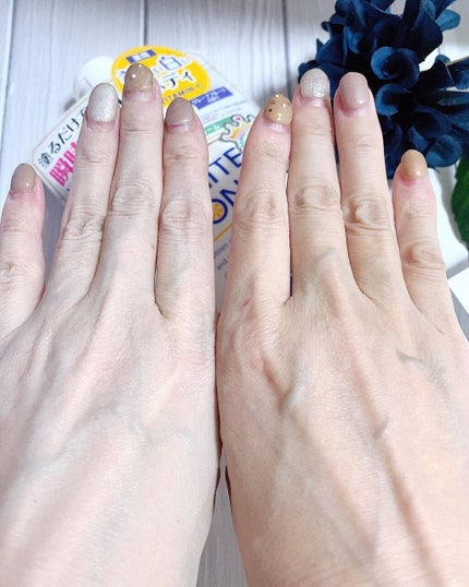 薬用ホワイトコンク ホワイトニングCC CII/ホワイトコンク/ボディクリームを使ったクチコミ(4枚目)