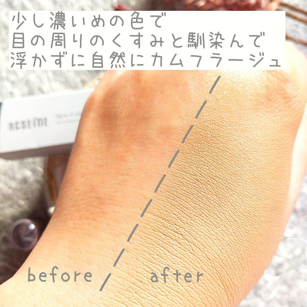 スキンカラーコントロール/ACSEINE/クリームコンシーラーを使ったクチコミ(4枚目)