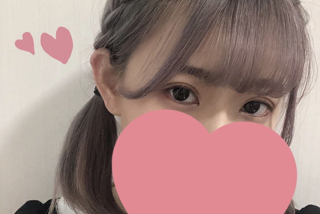 二重整形/その他を使ったクチコミ（2枚目）