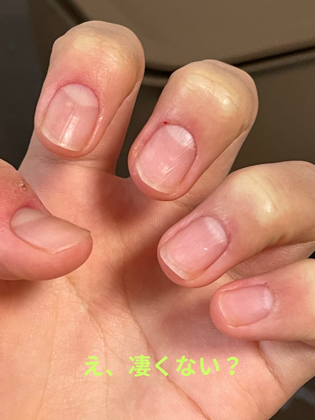 ウィンマックス キューティクルオイル/DAISO/ネイルオイル・トリートメントを使ったクチコミ(6枚目)