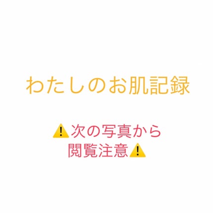 ハトムギ保湿ジェル(ナチュリエ スキンコンディショニングジェル)/ナチュリエ/美容液を使ったクチコミ(1枚目)