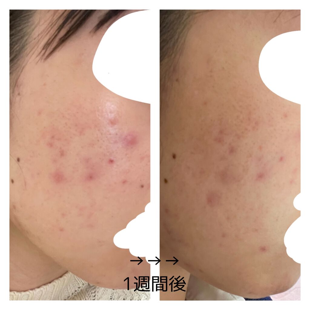 㪠㪠ð§žâ¡ on LIPS ããããæ¥èš2é±éç®2021/02/18ææŽé¡æããŒãããã¹ã¿é..ãïŒ5æç®ïŒ