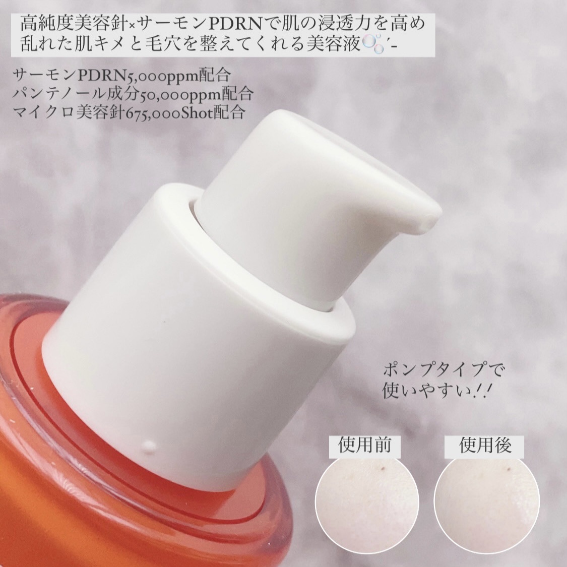 PDRNショット675/COSNORI/美容液を使ったクチコミ（2枚目）