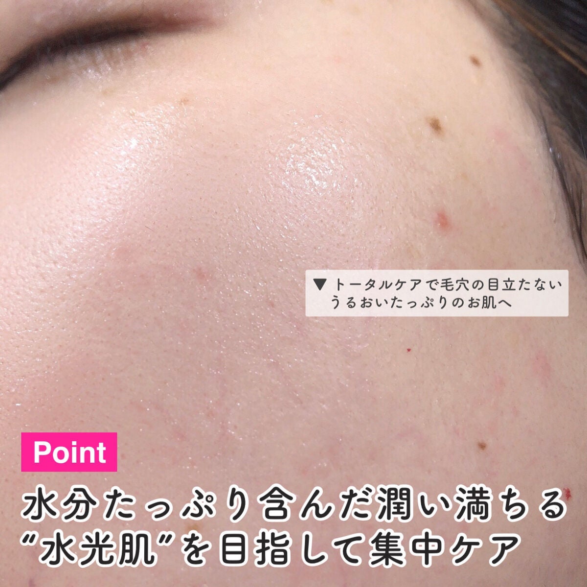 ルルルン ハイドラ V マスク/ルルルン/シートマスク・パックを使ったクチコミ(8枚目)