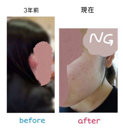薬用泡のふんわり洗顔/スキンライフ/泡洗顔を使ったクチコミ(3枚目)