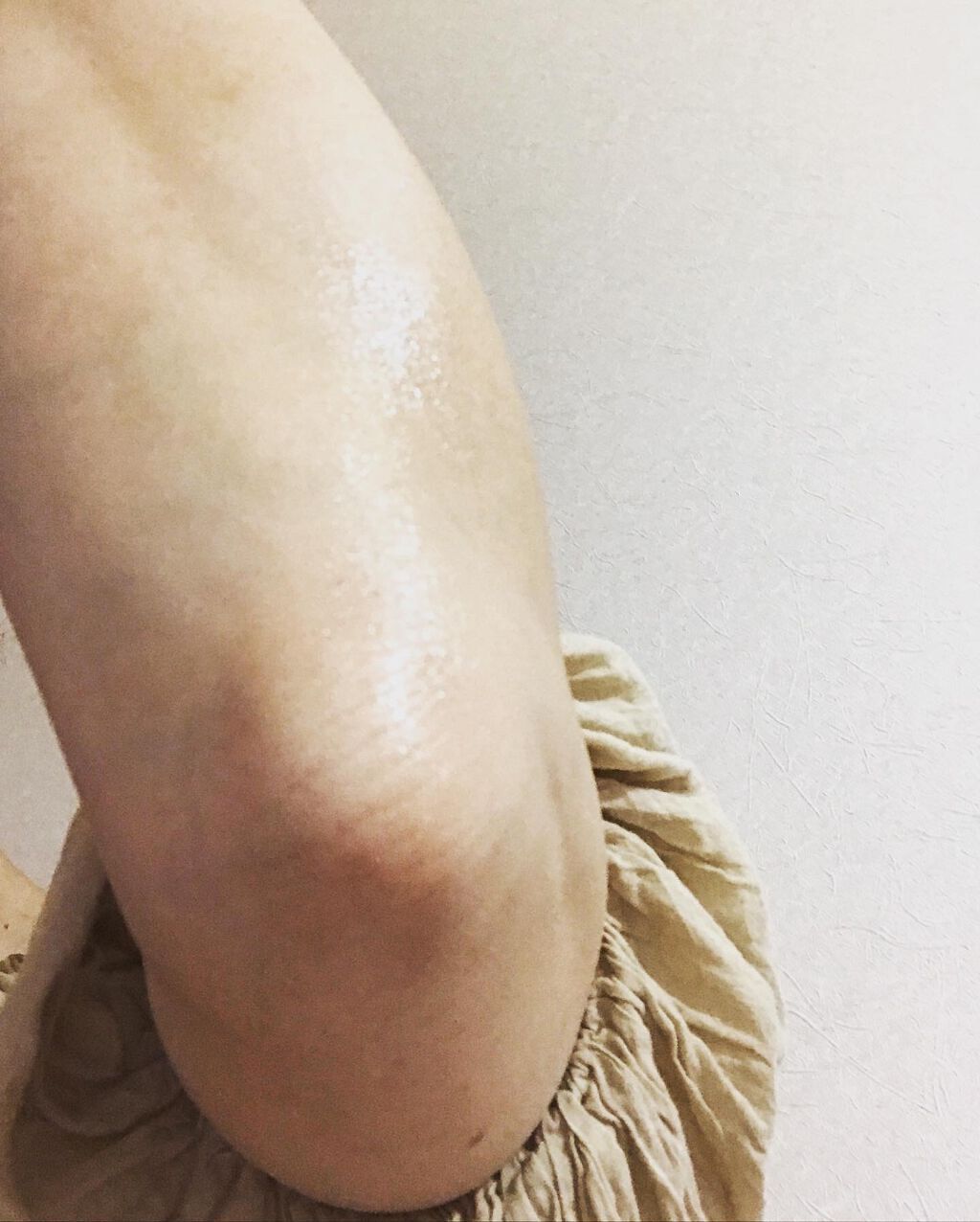 タカミスキンピールボディ/タカミ/ボディローションを使ったクチコミ(9枚目)