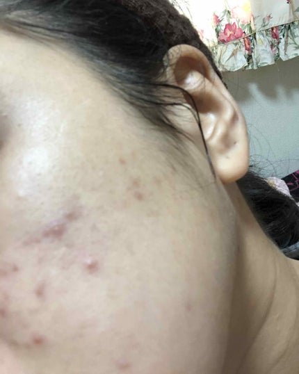 を使ったクチコミ(2枚目)