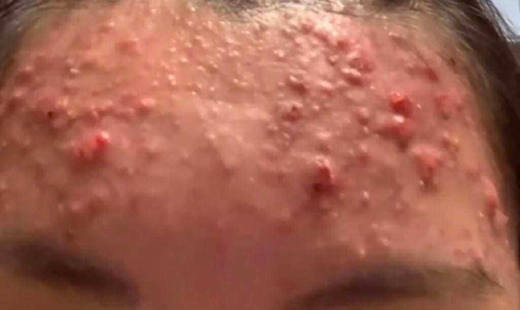 化粧水・敏感肌用・高保湿タイプ/無印良品/化粧水を使ったクチコミ(2枚目)