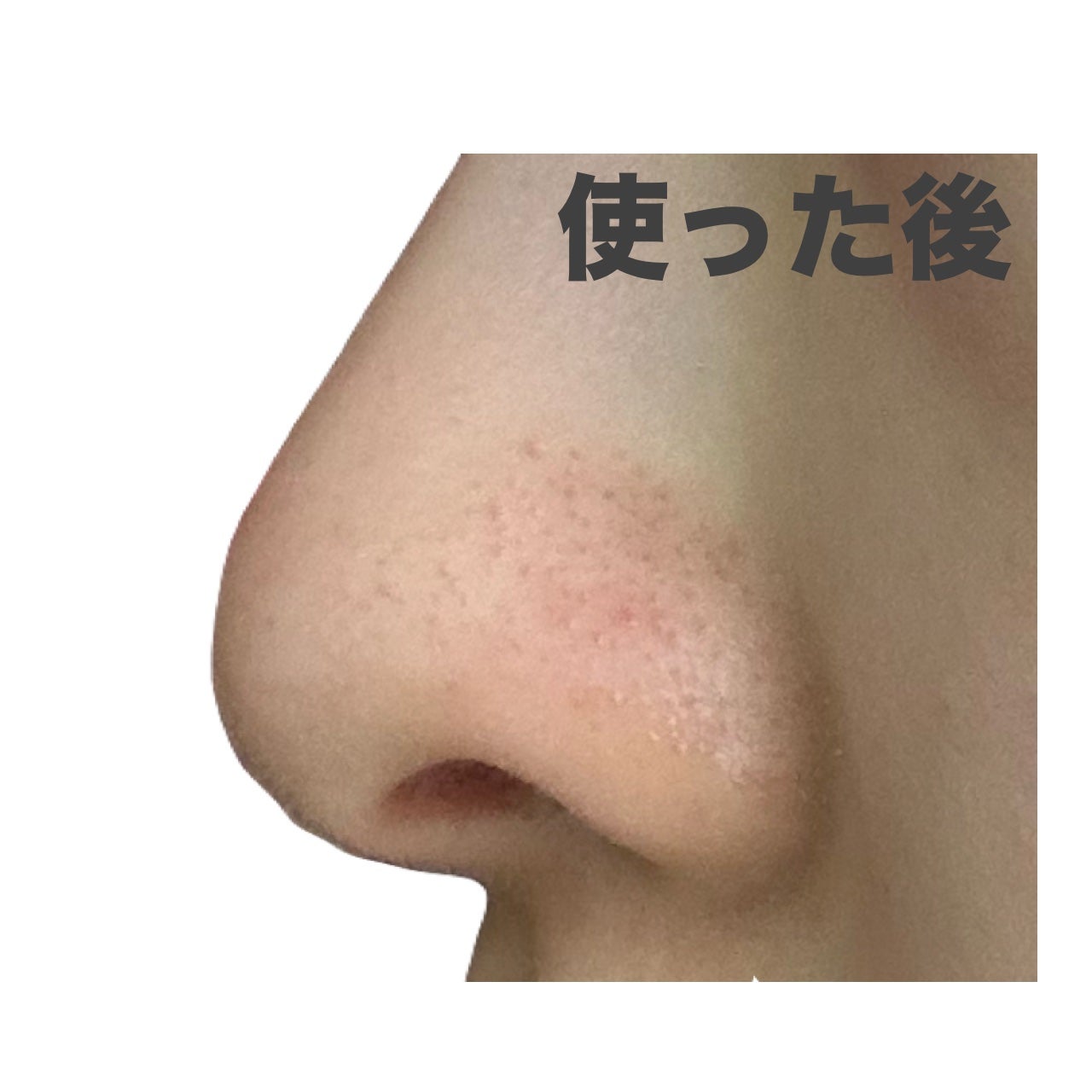 ゼロ毛穴パッド 2.0/MEDICUBE/トナーパッドを使ったクチコミ(5枚目)