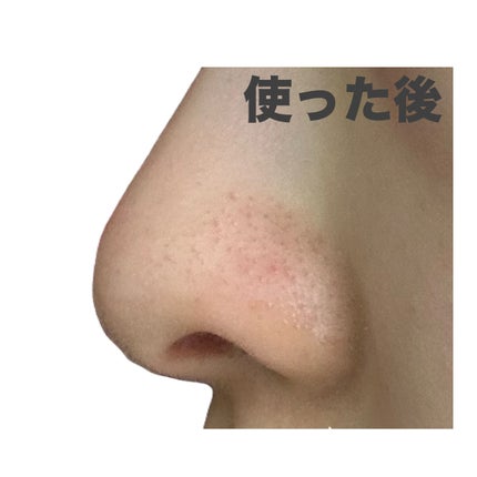 ゼロ毛穴パッド 2.0/MEDICUBE/トナーパッドを使ったクチコミ(5枚目)