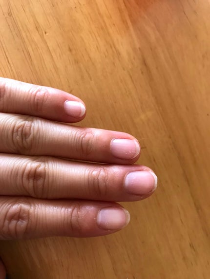 トリートメントネールリムーバー N/インテグレート/除光液を使ったクチコミ(6枚目)