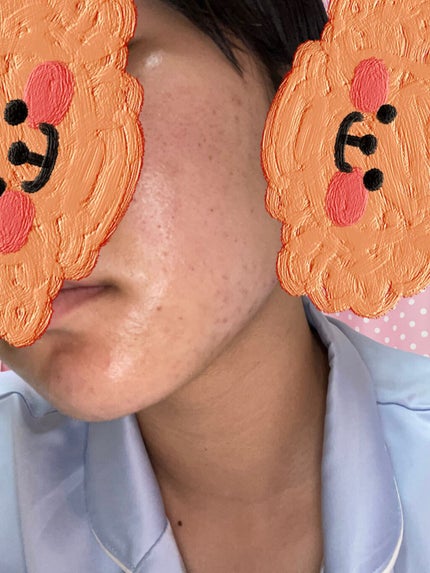 ハトムギ保湿ジェル(ナチュリエ スキンコンディショニングジェル)/ナチュリエ/美容液を使ったクチコミ(3枚目)