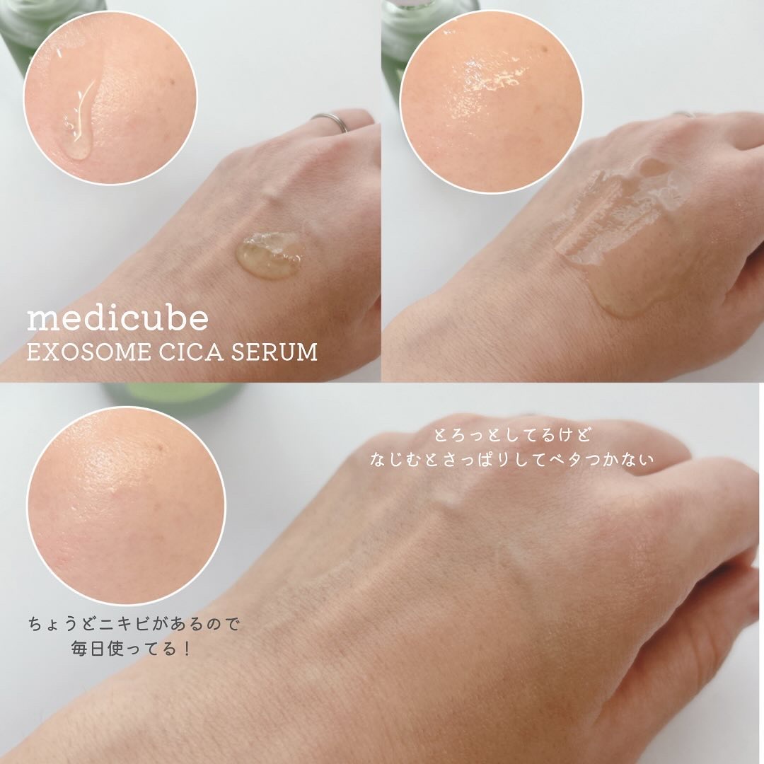 エクソソームシカ アンプル/MEDICUBE/美容液を使ったクチコミ（3枚目）