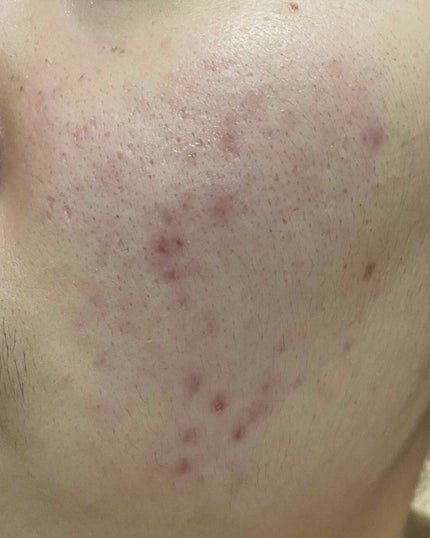 敏感肌用薬用美白美容液/無印良品/美容液を使ったクチコミ(3枚目)