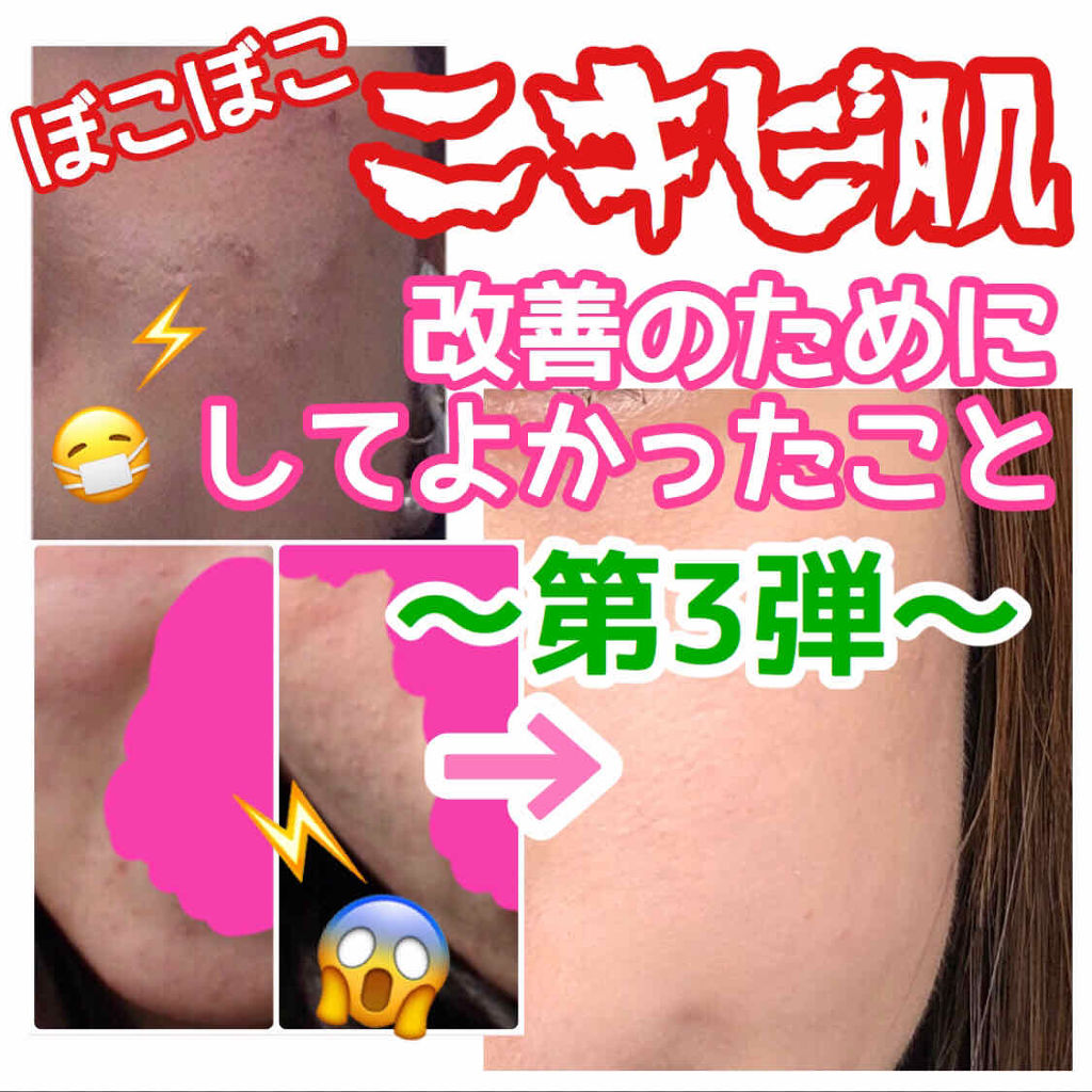 ハトムギ化粧水(ナチュリエ スキンコンディショナー R )/ナチュリエ/化粧水を使ったクチコミ（1枚目）