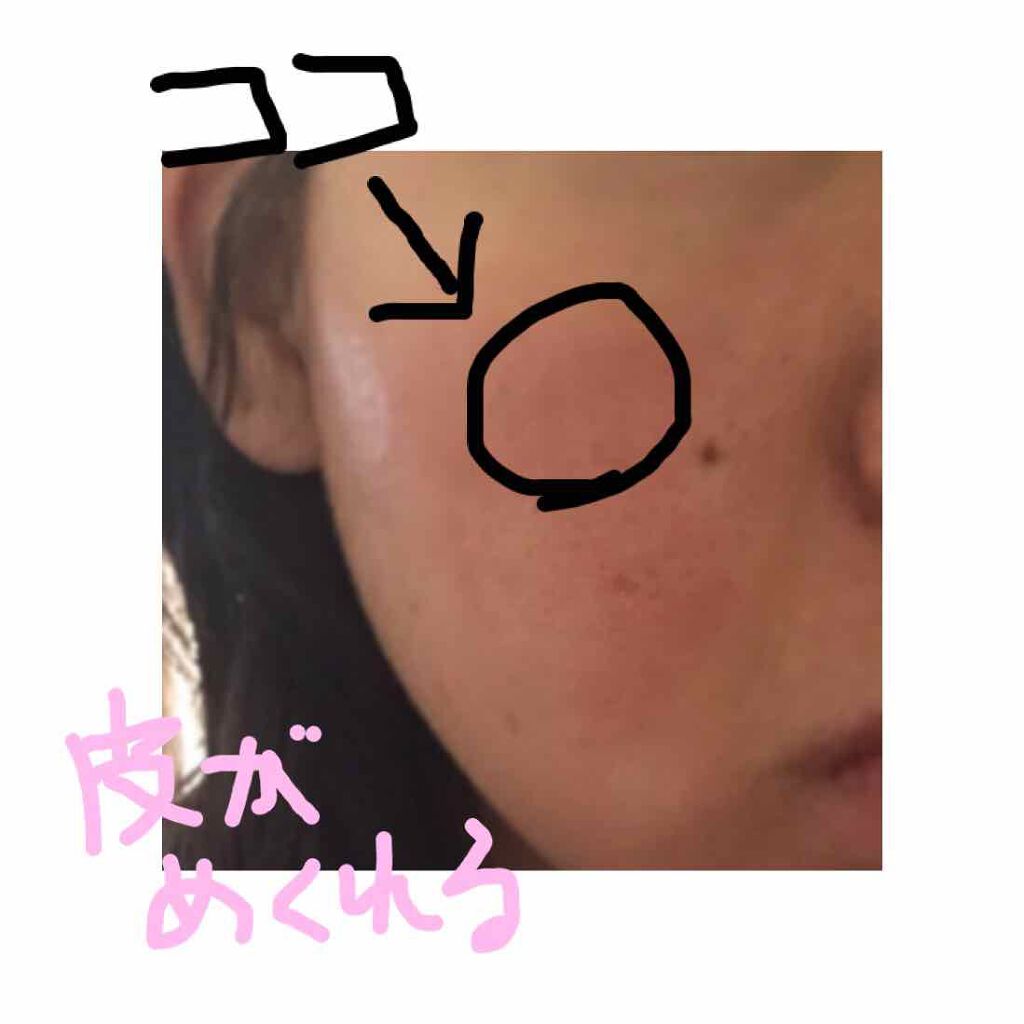 ハトムギ化粧水(ナチュリエ スキンコンディショナー R )/ナチュリエ/化粧水を使ったクチコミ（2枚目）