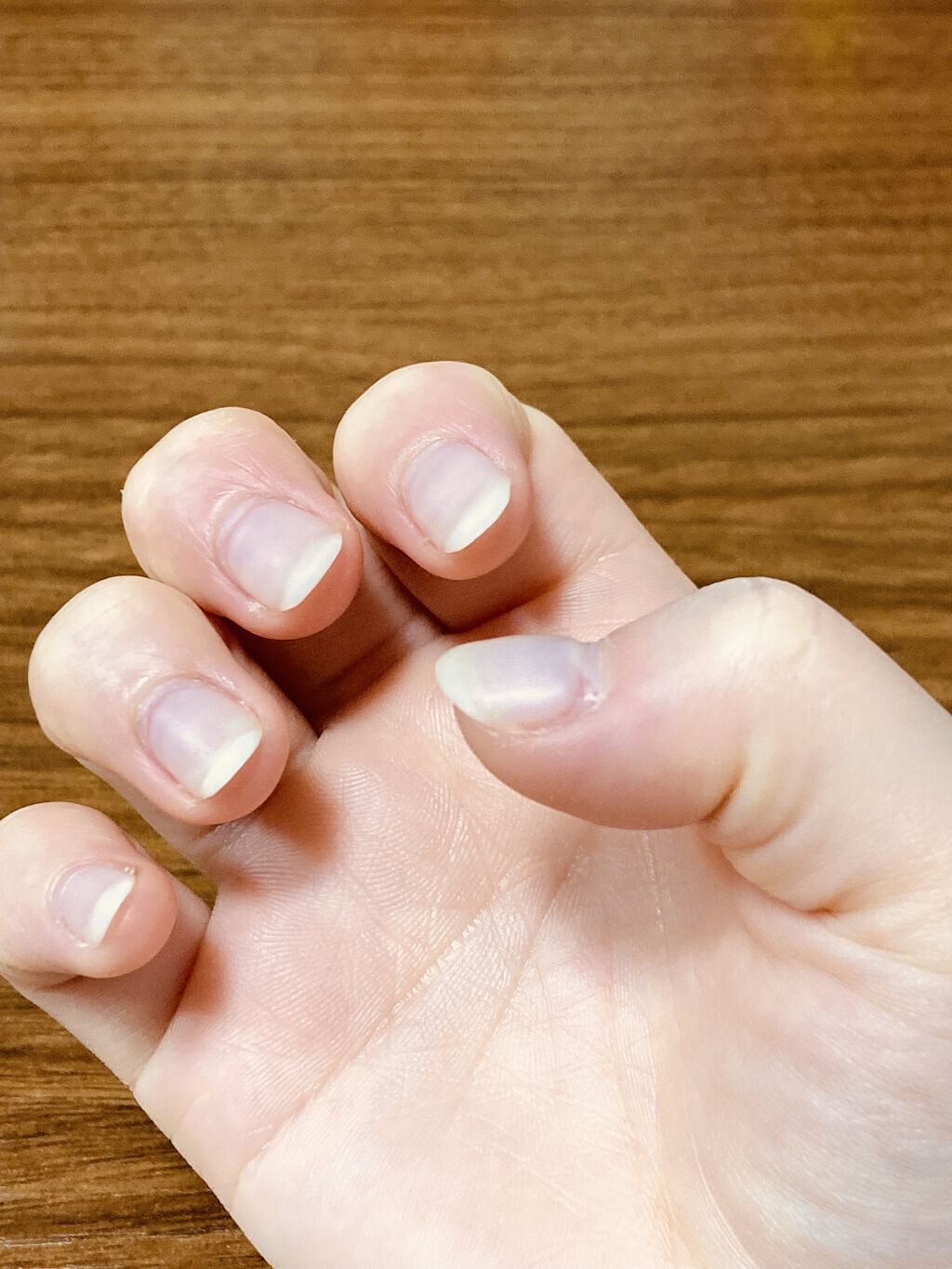 キューティクルオイル/ネイルホリック/ネイルオイル・トリートメントを使ったクチコミ（2枚目）