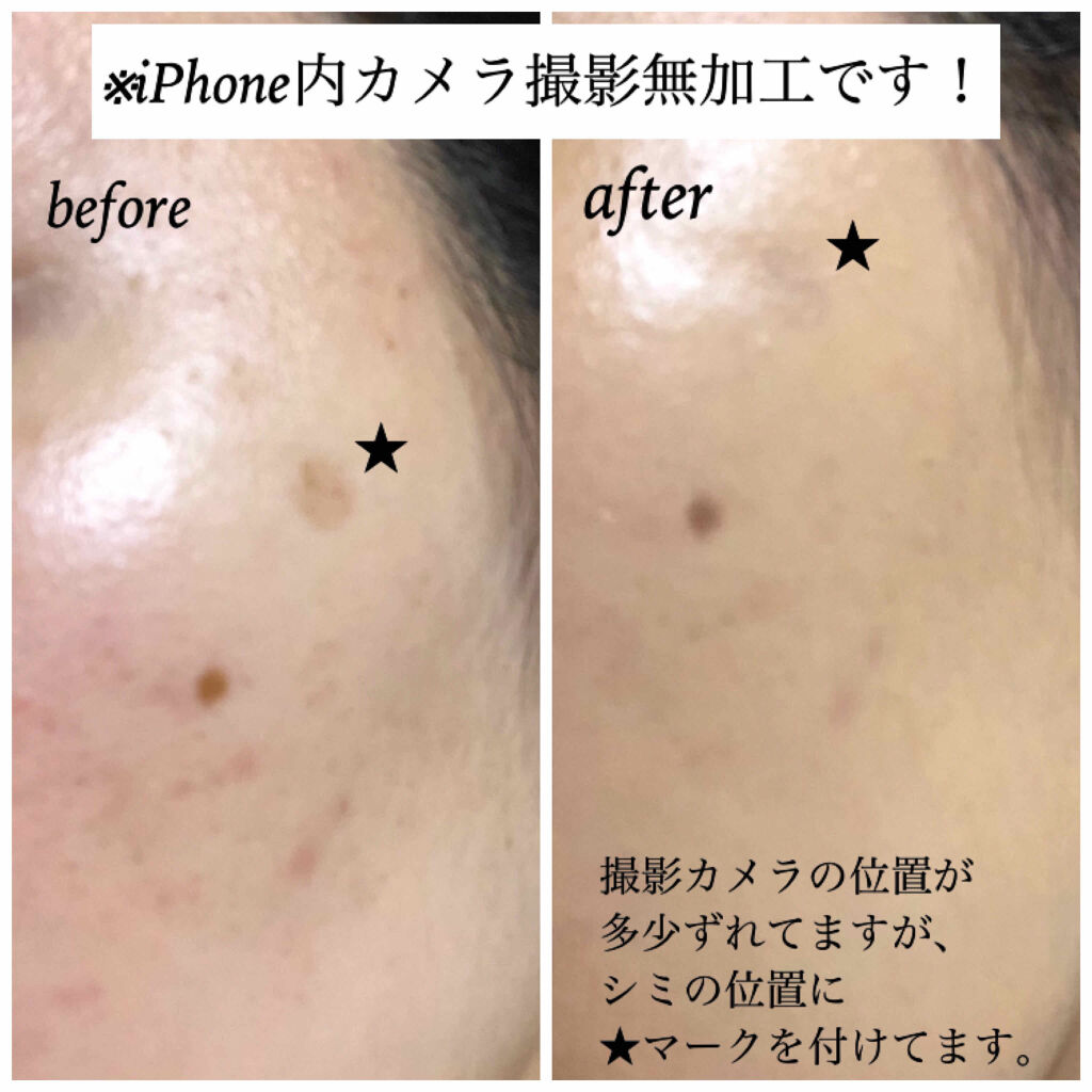 （旧）アンリミテッド ラスティング フルイド/shu uemura/リキッドファンデーションを使ったクチコミ（3枚目）