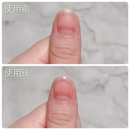 キューティクルペン/enieni /ネイルオイル・トリートメントを使ったクチコミ(4枚目)