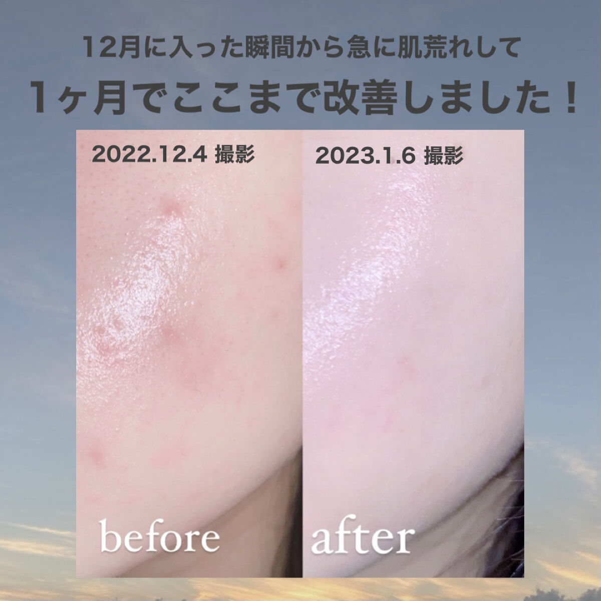 を使ったクチコミ（2枚目）