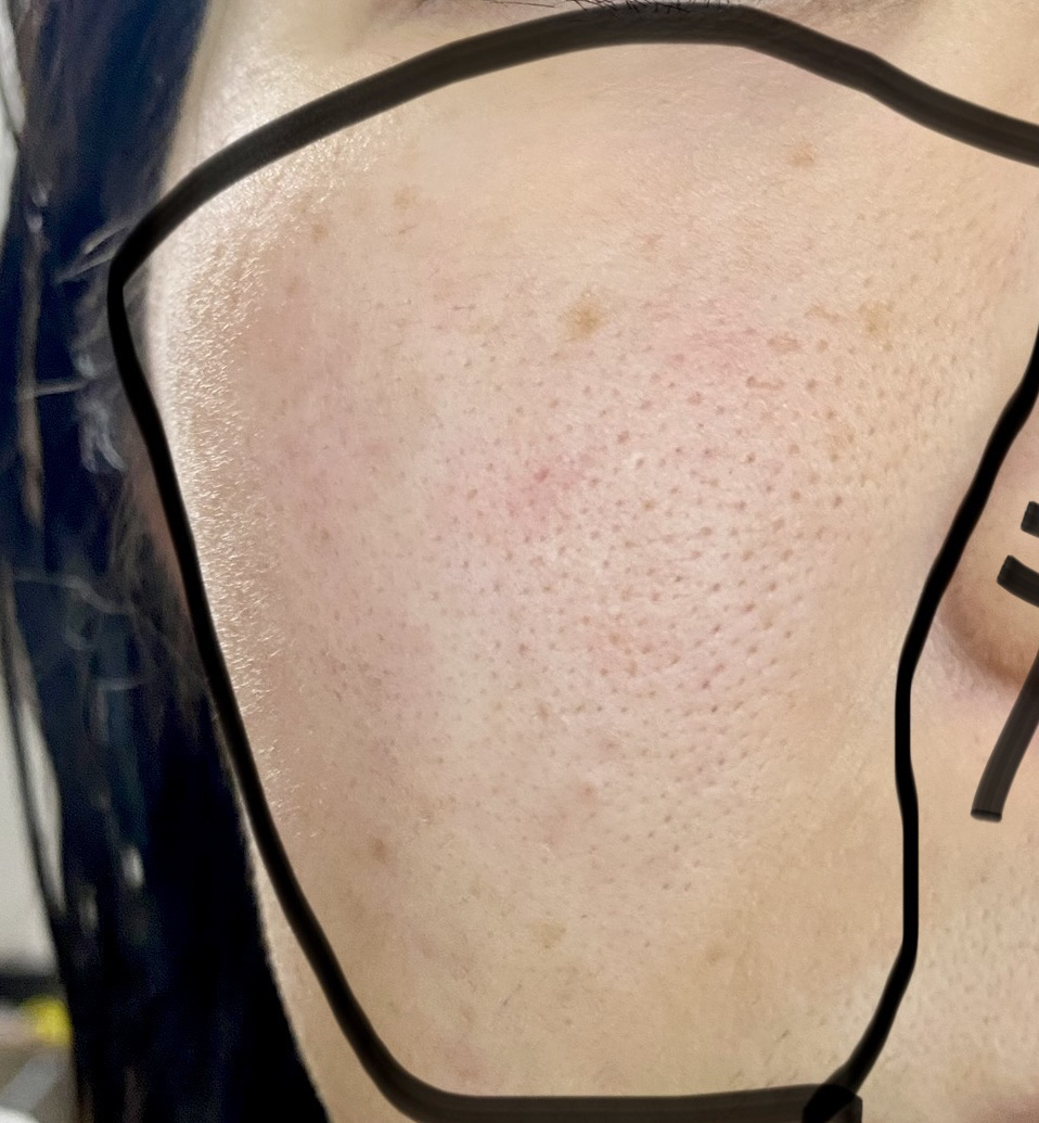 を使ったクチコミ（1枚目）