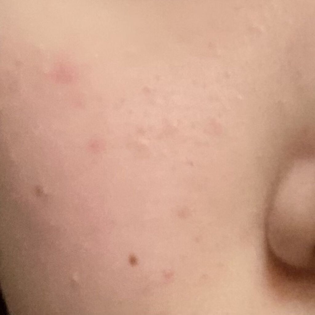 UR GLAM　CONCEALER PALETTE/U R GLAM/パレットコンシーラーを使ったクチコミ（2枚目）