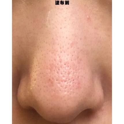 ホワイト パウダレスト/ALBION/パウダーファンデーションを使ったクチコミ(2枚目)