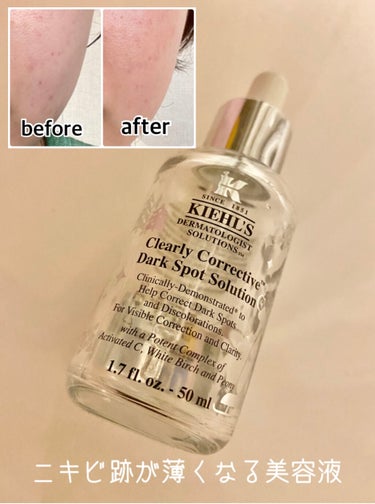 キールズ DS クリアリーブライト エッセンス[医薬部外品]/Kiehl's/美容液を使ったクチコミ（1枚目）