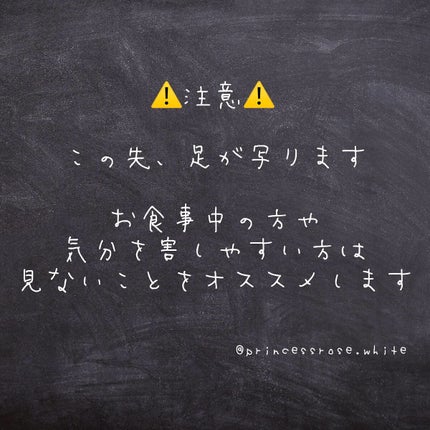 BODY MAKE PAD Milano collection model/大山式/レッグ・フットケアを使ったクチコミ(3枚目)