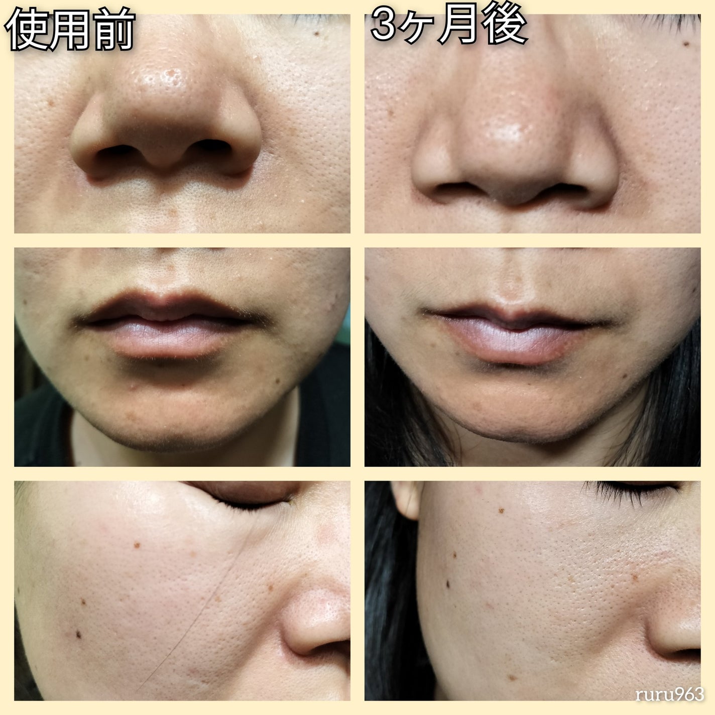 ビモラコスメ VC/BimoRa/美容液を使ったクチコミ(4枚目)