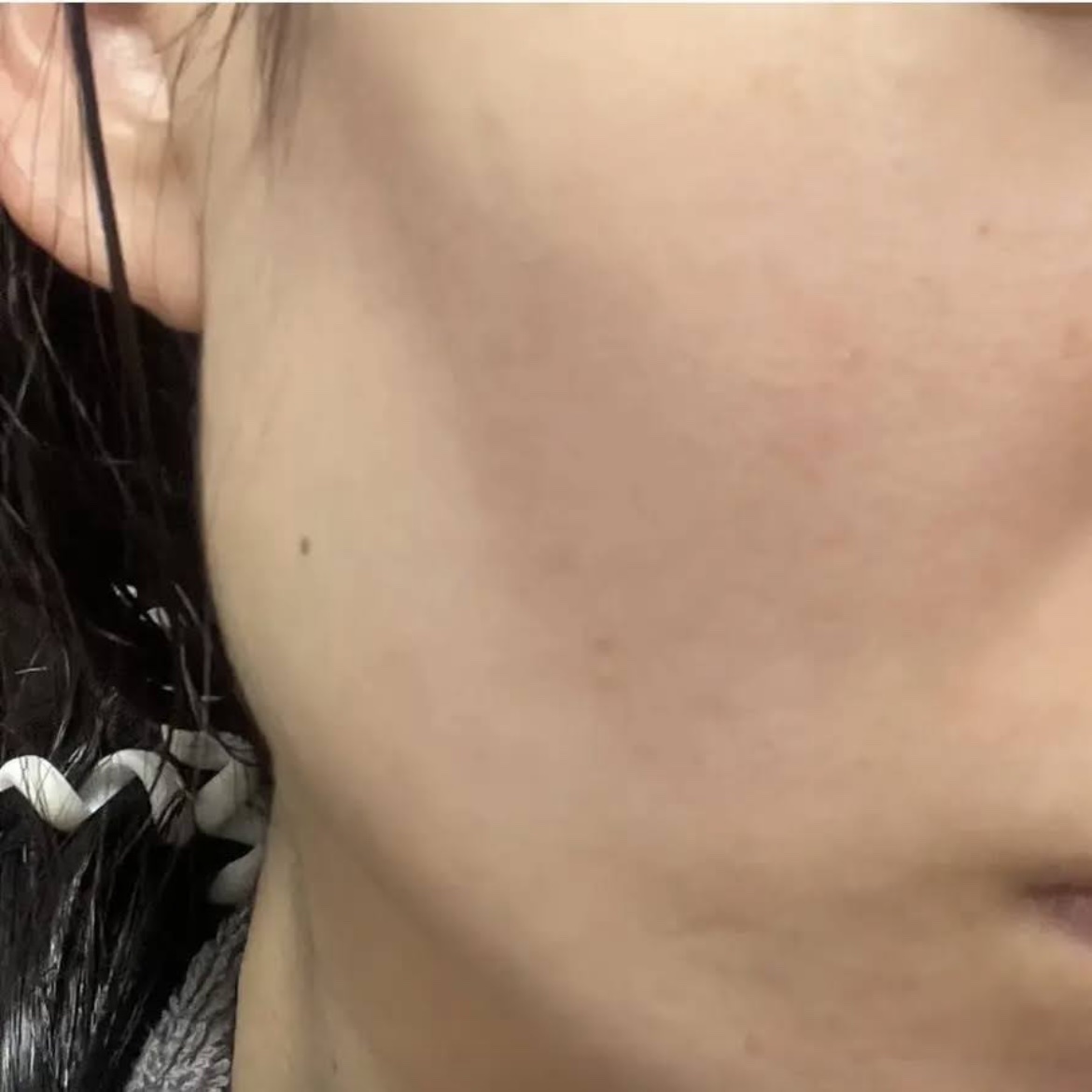 シカリニック HA バイオ エッセンス/CICALINIC/美容液を使ったクチコミ（3枚目）