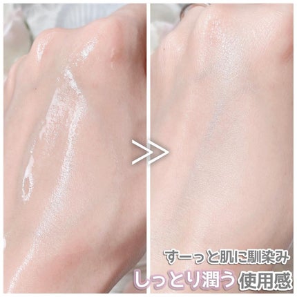 Kombuchaブラックティー90トリートメントエッセンス/ネイチャーリパブリック/化粧水を使ったクチコミ(5枚目)