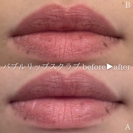 ブビブビ リップマスク/unpa/リップマスクを使ったクチコミ(5枚目)