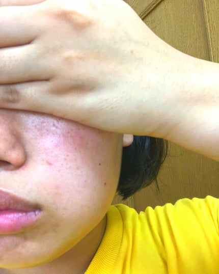 プロフィニッシュファンデーション 特製セット Ⅰ/インテグレート/メイクアップキットを使ったクチコミ(2枚目)